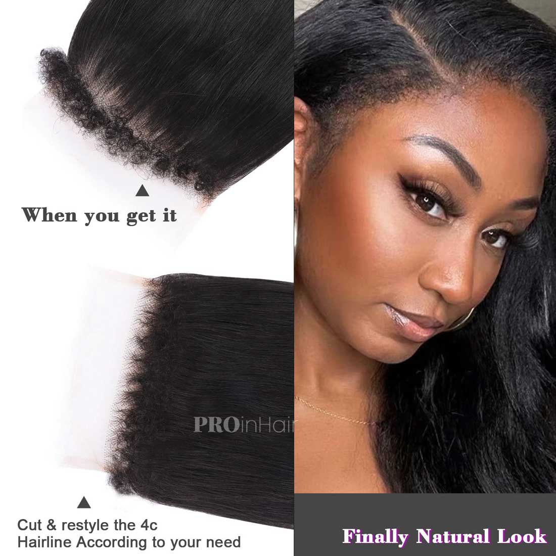 Affordable Kinky Straight with 4C Edges Hairline 5X5 HD Closure  Super Thin HD Closure